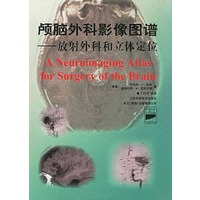 颅脑外科影像图谱(放射外科和立体定位)(精)