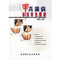 甲真菌病诊治彩色图谱(精)