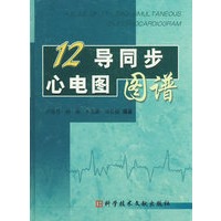 12导同步心电图图谱